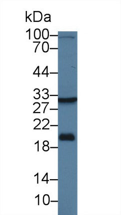 Western Blot; Sample: Recombinant protein.