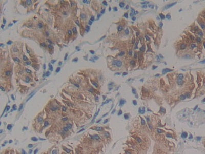 DAB staining on fromalin fixed paraffin- embedded Kidney tissue)