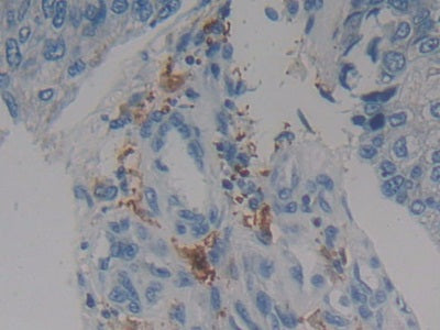 17-Beta-Hydroxysteroid Dehydrogenase Type 12 (HSD17b12) Polyclonal Antibody - image 5