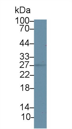 Western Blot; Sample: Recombinant protein.