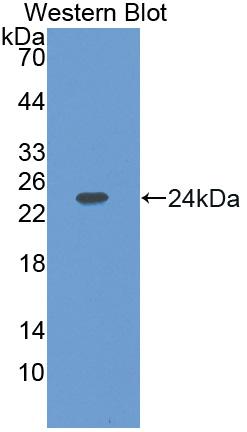DAB staining on IHC-P; Samples: Mouse Heart Tissue; Primary Ab: 30µg/ml Rabbit Anti-Mouse HSD17b10 Antibody Second Ab: 2µg/mL HRP-Linked Caprine Anti-Rabbit IgG Polyclonal Antibody