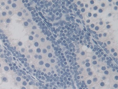 17-Beta-Hydroxysteroid Dehydrogenase Type 10 (HSD17b10) Polyclonal Antibody - image 5