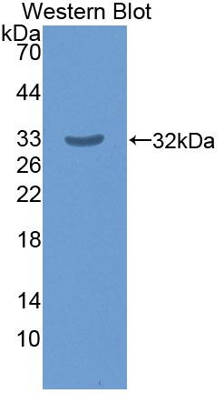 17-Beta-Hydroxysteroid Dehydrogenase Type 14 (HSD17b14) Polyclonal Antibody - image 2