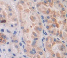 17-Beta-Hydroxysteroid Dehydrogenase Type 14 (HSD17b14) Polyclonal Antibody - image 3