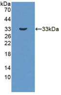 17-Beta-Hydroxysteroid Dehydrogenase Type 3 (HSD17b3) Polyclonal Antibody - image 2