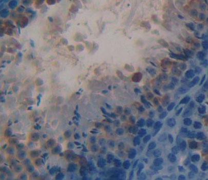 17-Beta-Hydroxysteroid Dehydrogenase Type 3 (HSD17b3) Polyclonal Antibody - image 3