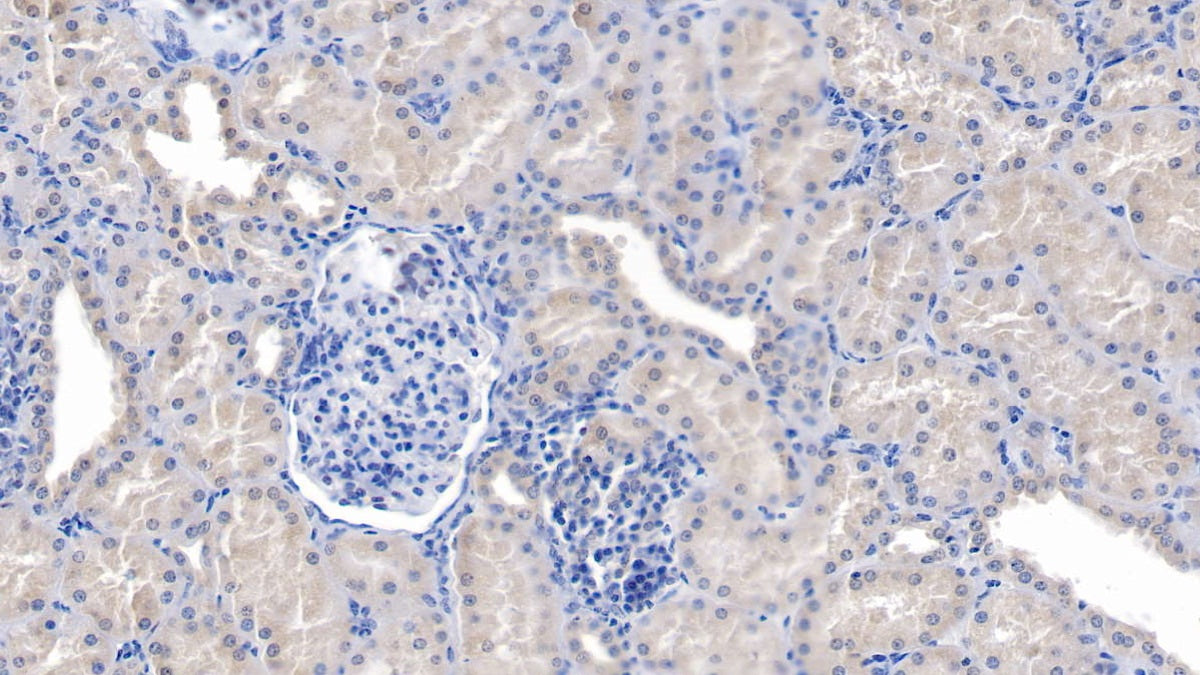 Ring Finger Protein 39 (RNF39) Polyclonal Antibody - image 4