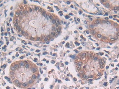 DAB staining on fromalin fixed paraffin- embedded Kidney tissue)