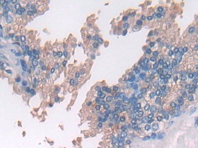 Ring Finger Protein 55 (RNF55) Polyclonal Antibody - image 4