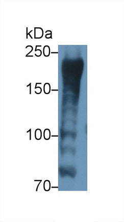 DAB staining on IHC-P; Samples: Human Placenta Tissue; Primary Ab: 20μg/ml Rabbit Anti-Human AKAP12 Antibody Second Ab: 2µg/mL HRP-Linked Caprine Anti-Rabbit IgG Polyclonal Antibody