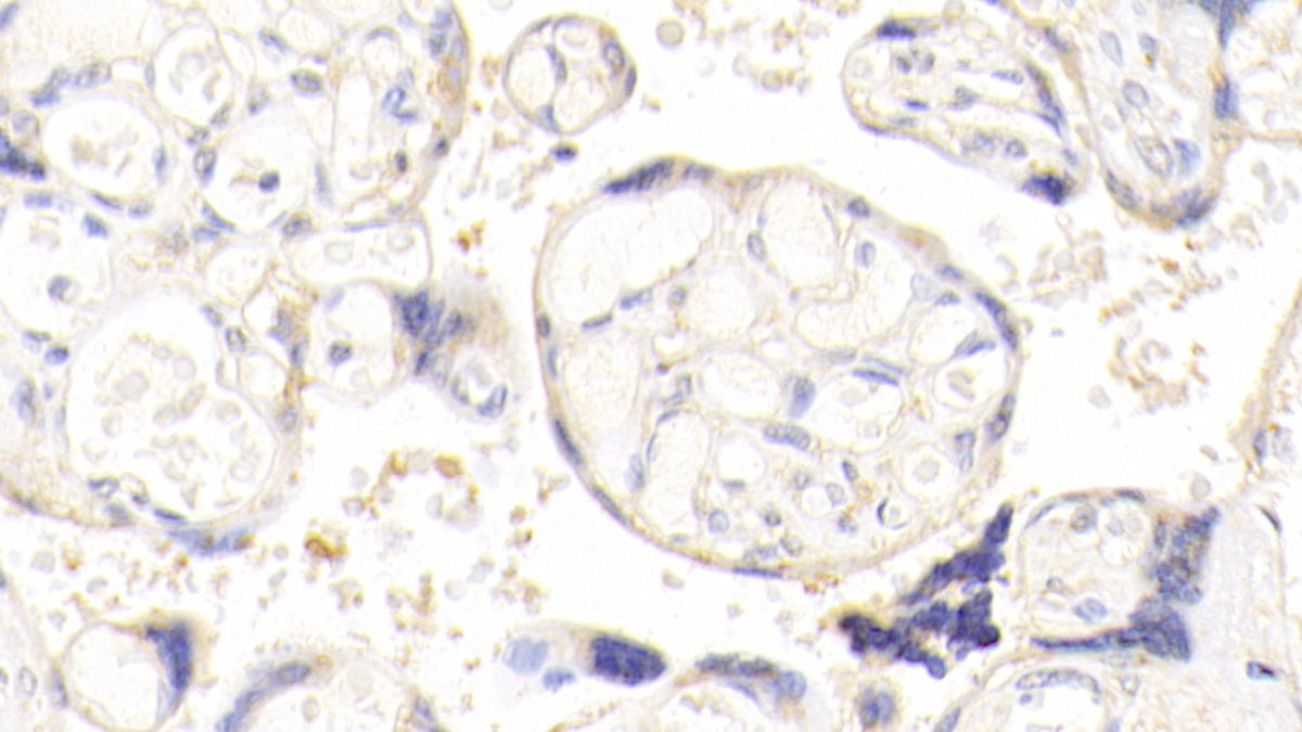 DAB staining on fromalin fixed paraffin-embedded ovary tissue)