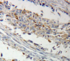 A Kinase Anchor Protein 12 (AKAP12) Polyclonal Antibody - image 5