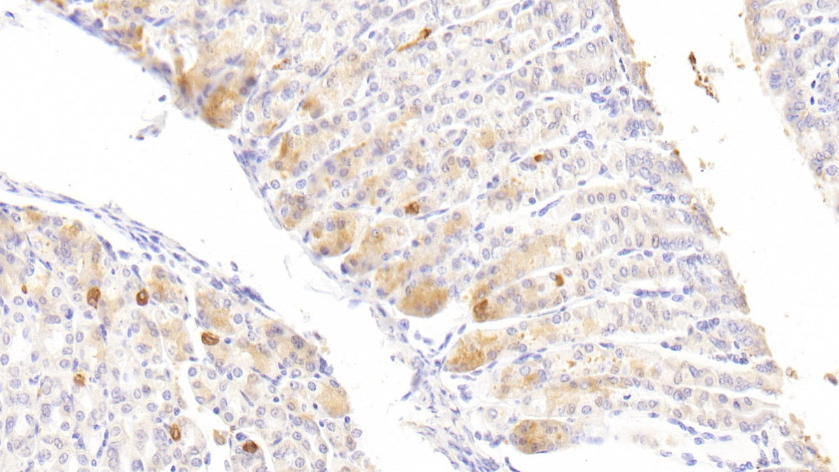 DAB staining on fromalin fixed paraffin- embedded Kidney tissue)