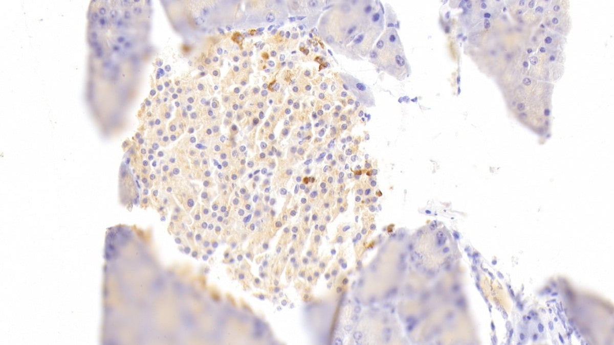 Diacylglycerol Kinase Zeta (DGKz) Polyclonal Antibody - image 4