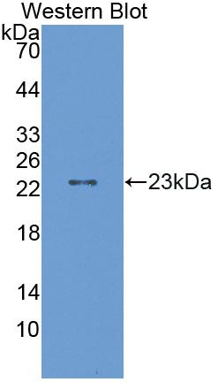 DAB staining on IHC-P; Samples: Mouse Ovary Tissue; Primary Ab: 10µg/ml Rabbit Anti-Mouse ALDH9A1 Antibody Second Ab: 2µg/mL HRP-Linked Caprine Anti-Rabbit IgG Polyclonal Antibody