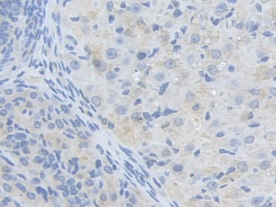 DAB staining on IHC-P; Samples: Mouse Testis Tissue; Primary Ab: 10µg/ml Rabbit Anti-Mouse ALDH9A1 Antibody Second Ab: 2µg/mL HRP-Linked Caprine Anti-Rabbit IgG Polyclonal Antibody