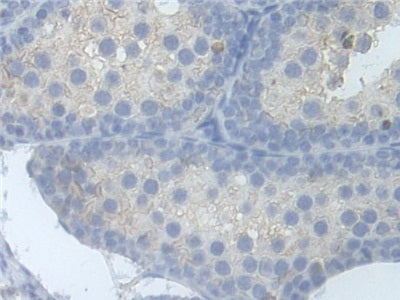 Aldehyde Dehydrogenase 9 Family, Member A1 (ALDH9A1) Polyclonal Antibody - image 5