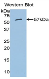 Western Blot; Sample: Lane1: Rat Liver lysate; Lane2: Rat Cerebrum lysate; Lane3: Rat Heart lysate; Primary Ab: 2µg/mL Rabbit Anti-Rat ALDH7A1 Antibody; Second Ab: 0.2µg/mL HRP-Linked Caprine Anti-Rabbit IgG Polyclonal Antibody;