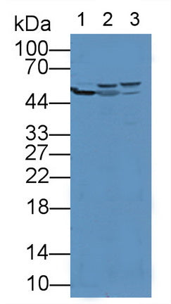 DAB staining on IHC-P; Samples: Rat Kidney Tissue; Primary Ab: 20µg/ml Rabbit Anti-Rat ALDH7A1 Antibody Second Ab: 2µg/mL HRP-Linked Caprine Anti-Rabbit IgG Polyclonal Antibody