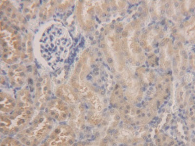 Aldehyde Dehydrogenase 7 Family, Member A1 (ALDH7A1) Polyclonal Antibody - image 4