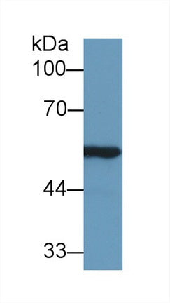 Western Blot; Sample: Recombinant protein.
