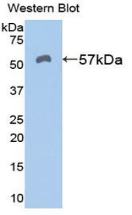 DAB staining on IHC-P; Samples: Mouse Liver Tissue;  Primary Ab: 10µg/ml Rabbit Anti-Mouse ALDH7A1 A
