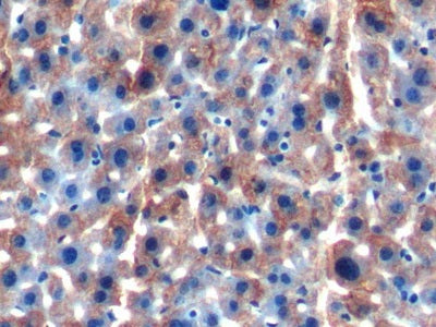 Aldehyde Dehydrogenase 7 Family, Member A1 (ALDH7A1) Polyclonal Antibody - image 4