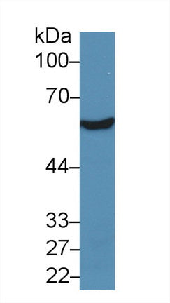 Western Blot; Sample: Recombinant protein.