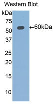 DAB staining on IHC-P; Samples: Human Kidney Tissue;  Primary Ab: 20µg/ml Rabbit Anti-Human ALDH7A1