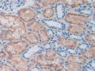 Aldehyde Dehydrogenase 7 Family, Member A1 (ALDH7A1) Polyclonal Antibody - image 5