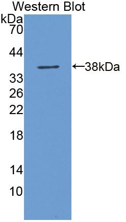 DAB staining on IHC-P; Samples: Human Liver Tissue; Primary Ab: 20µg/ml Rabbit Anti-Human ALDH3A1 Antibody Second Ab: 2µg/mL HRP-Linked Caprine Anti-Rabbit IgG Polyclonal Antibody