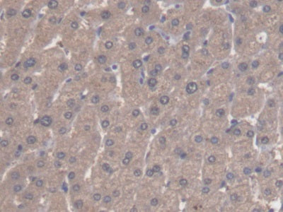 DAB staining on IHC-P; Samples: Human Pancreas Tissue; Primary Ab: 20µg/ml Rabbit Anti-Human ALDH3A1 Antibody Second Ab: 2µg/mL HRP-Linked Caprine Anti-Rabbit IgG Polyclonal Antibody