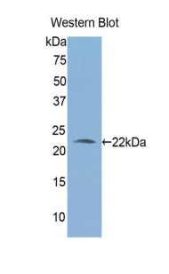 Aldehyde Dehydrogenase 1 Family, Member A3 (ALDH1A3) Polyclonal Antibody - image 2
