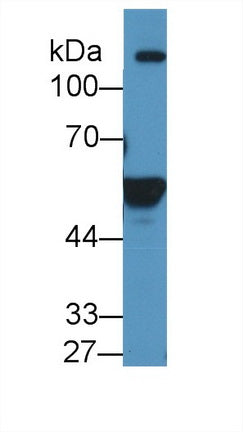 Western Blot; Sample: Recombinant protein.