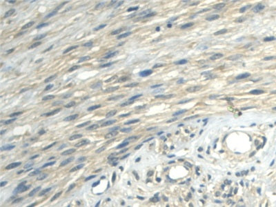 Aldehyde Dehydrogenase 1 Family, Member A2 (ALDH1A2) Polyclonal Antibody - image 5