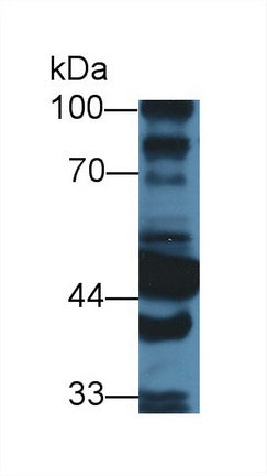 Western Blot; Sample: Recombinant protein.