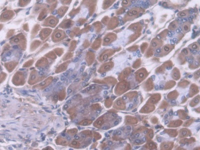DAB staining on fromalin fixed paraffin- embedded testis tissue)