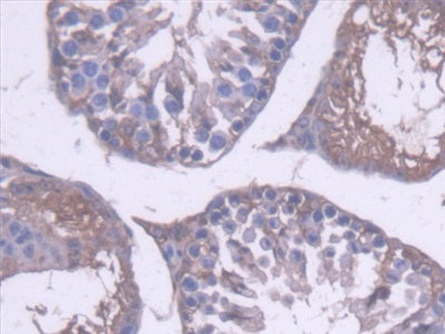 Aldehyde Dehydrogenase 1 Family, Member A1 (ALDH1A1) Polyclonal Antibody - image 5