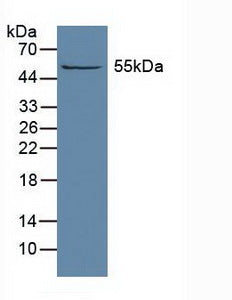 Western Blot; Sample: Recombinant ALDH1A1, Human.