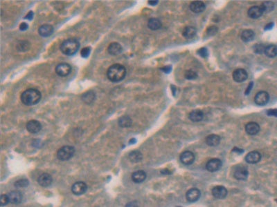 DAB staining on IHC-P; Samples: Human Kidney Tissue.