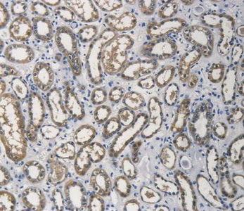 Aldehyde Dehydrogenase 1 Family, Member A1 (ALDH1A1) Polyclonal Antibody - image 5