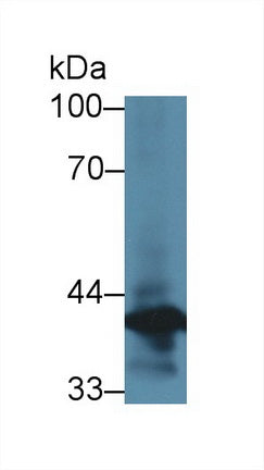 Western Blot; Sample: Recombinant protein.