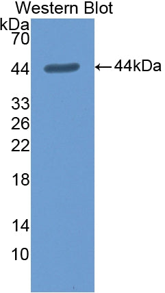 DAB staining on IHC-P; Samples: Rat Stomach Tissue;  Primary Ab: 20µg/ml Rabbit Anti-Rat ANXA1 Antibody Second Ab: 2µg/mL HRP-Linked Caprine Anti-Rabbit IgG Polyclonal Antibody