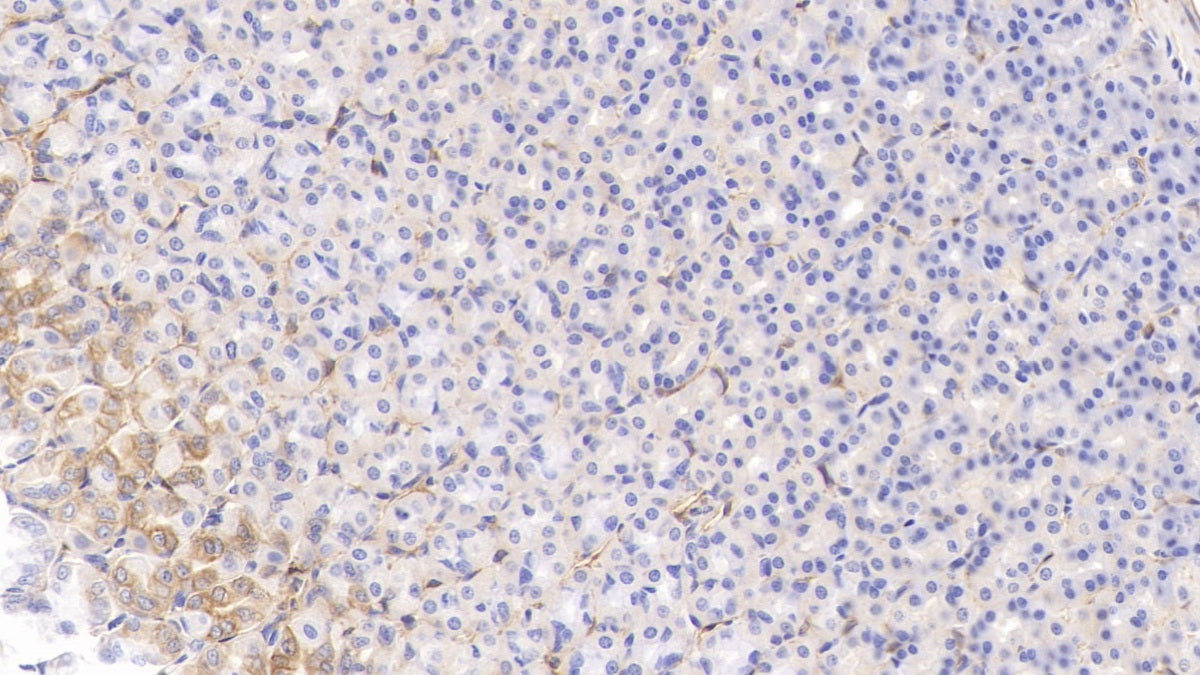 DAB staining on fromalin fixed paraffin-embedded kidney tissue)