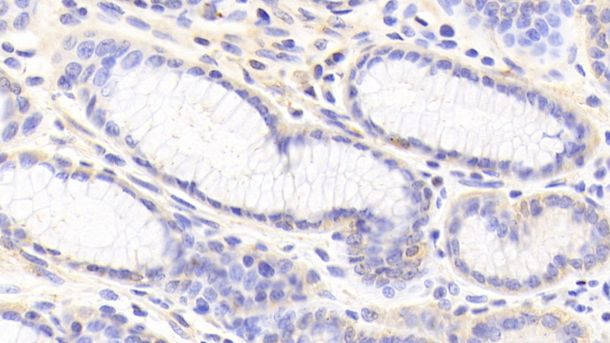 DAB staining on IHC-P; Samples: Porcine Spleen Tissue; Primary Ab: 20μg/ml Rabbit Anti-Porcine ANXA1 Antibody Second Ab: 2µg/mL HRP-Linked Caprine Anti-Rabbit IgG Polyclonal Antibody