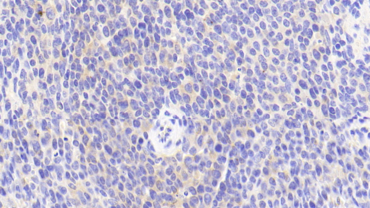 Annexin A1 (ANXA1) Polyclonal Antibody - image 5