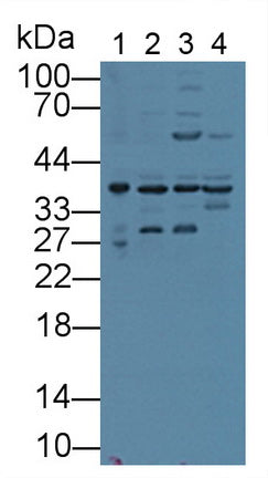 DAB staining on IHC-P; Samples: Mouse Lung Tissue; Primary Ab: 10μg/ml Rabbit Anti-Mouse ANXA1 Antibody Second Ab: 2µg/mL HRP-Linked Caprine Anti-Rabbit IgG Polyclonal Antibody