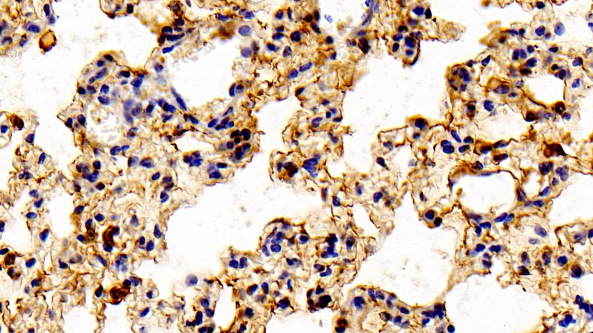 DAB staining on fromalin fixed paraffin-embedded Spleen tissue)