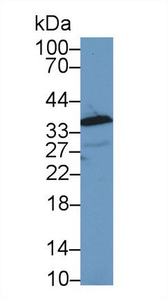 Western Blot; Sample: Recombinant protein.