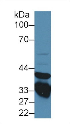 Western Blot; Sample: Recombinant protein.